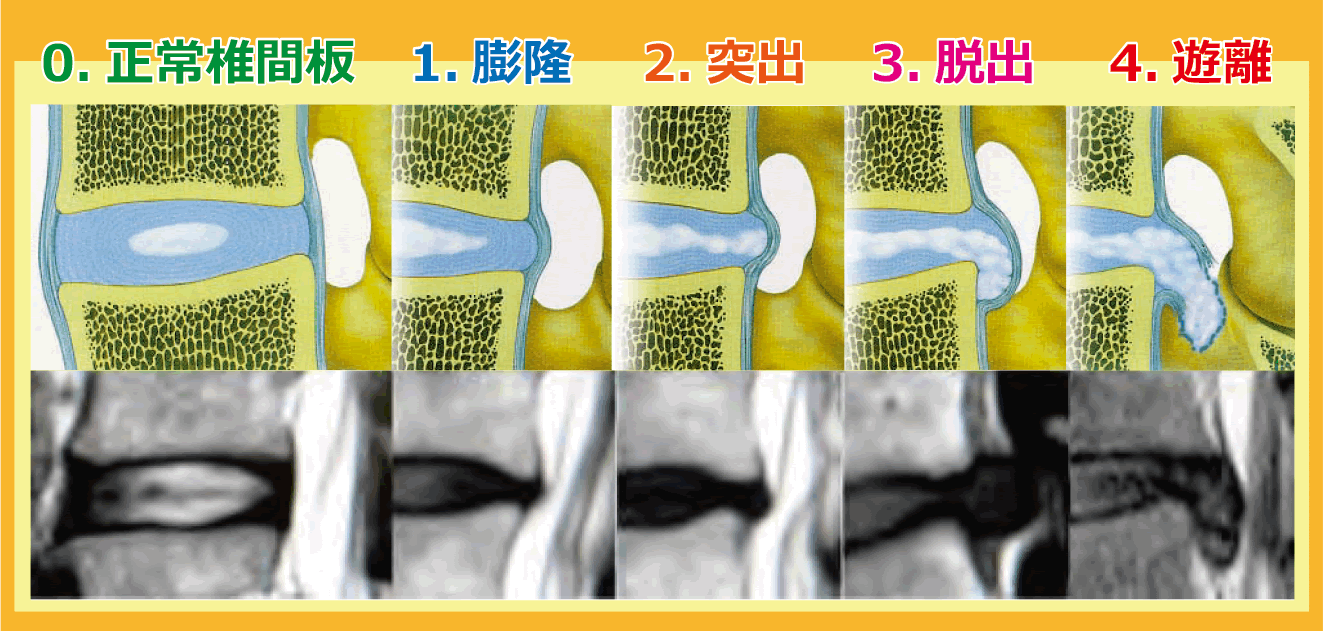 トラブルの防止